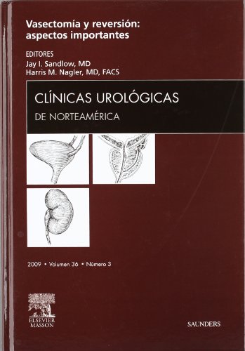 Imagen de archivo de Clnicas Urolgicas de Norteamrica 2009. Volumen 36 n 3: Vasectoma y reversin: aspectos importantes a la venta por Agapea Libros