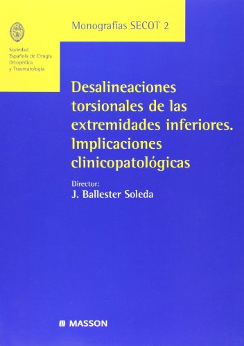 Beispielbild fr Desalineaciones torsionales de las exBallester, Monografas SECOT 2 / zum Verkauf von Iridium_Books