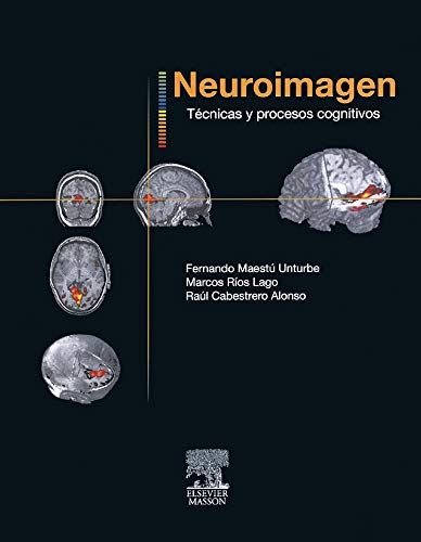 9788445824665: Neuroimagen. Tcnicas y procesos cognitivos (Spanish Edition)