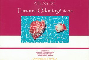 Imagen de archivo de ATLAS DE TUMORES ODONTOGENICOS a la venta por KALAMO LIBROS, S.L.