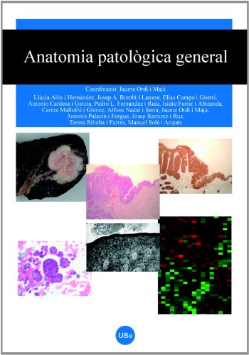 9788447531295: Anatomia patolgica general (MEDICA UB) (Spanish Edition)