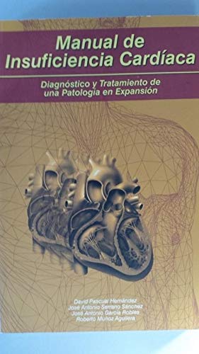 Beispielbild fr Manual de Insuficiencia Cardaca: Diagnstico y Tratamiento de Una Patologa en Expansin zum Verkauf von Hamelyn