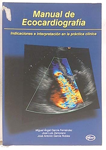 9788468896984: Manual De Ecocardiografa, Indicacinoes E Interpretaciones En La Prctica