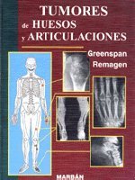 Stock image for Tumores de Huesos y Articulaciones (Spanish Edition) for sale by Iridium_Books