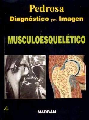 Imagen de archivo de Pedrosa Diagnostico Por Imagen Musculoesqueletico a la venta por Libros del Mundo