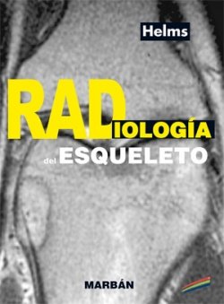 Beispielbild fr Radiologia Del Esqueleto - Residente - Helms zum Verkauf von Libros del Mundo