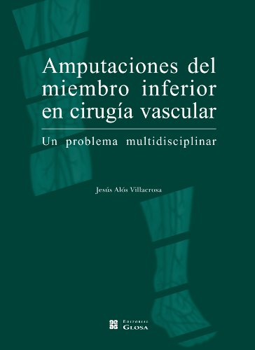 Imagen de archivo de Amputaciones del miembro inferior en ciruga vascular. Un problema multidisciplinar (Spanish Edition) a la venta por ThriftBooks-Dallas