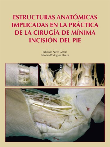 9788474294491: Estructuras Anatmicas Implicadas En La Prctica De La Ciruga De Mnima Incisin Del Pie