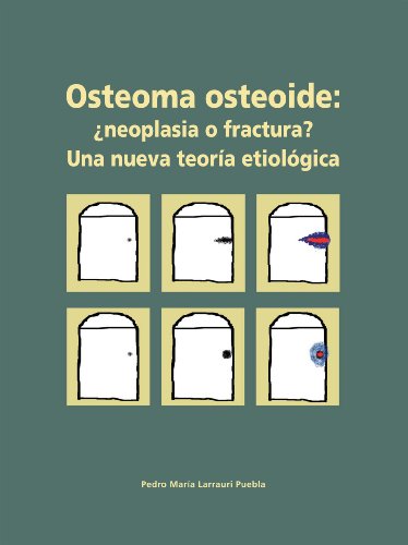 Beispielbild fr Osteoma osteoide: neoplasia o fractura?: Una nueva teora etiolgica (Spanish Edition) zum Verkauf von Iridium_Books