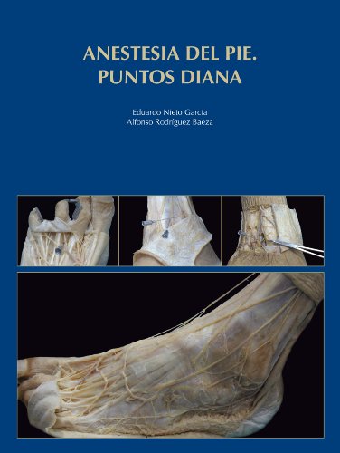 Beispielbild fr Anestesia del pie. Puntos diana (Spanish Edition) zum Verkauf von Iridium_Books