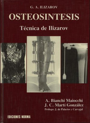 Stock image for Osteosintesis: Tecnica de Ilizarov (Ortopedia) for sale by Iridium_Books