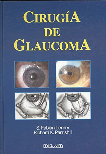 Imagen de archivo de Cirugia de glaucoma a la venta por Iridium_Books
