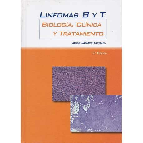 Imagen de archivo de Linfomas B y T. Biologa, clnica y tratamiento. a la venta por Mercado de Libros usados de Benimaclet