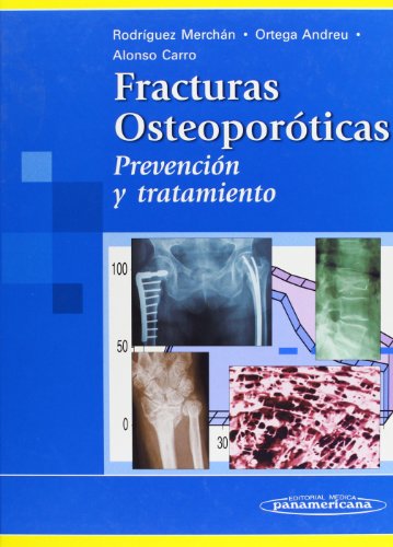 Beispielbild fr Fracturas Osteoporticas. Prevencin y Tratamiento zum Verkauf von Hamelyn