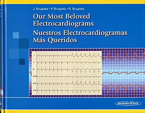 Stock image for OUR MOST BELOVED ELECTROCARDIOGRAMS. NUESTROS ELECTROCARDIOGRAMAS MS QUERIDOS ( for sale by Zilis Select Books