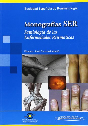Imagen de archivo de Semiologia De Las Enfermedades ReumatSER Sociedad Espaola De Reumato a la venta por Iridium_Books