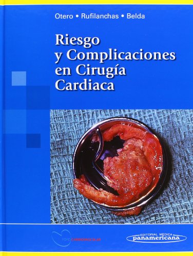 Stock image for Riesgo y Complicaciones en Ciruga CaOtero Coto, Eduardo / Rufilancha for sale by Iridium_Books