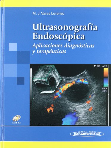Ultrasonografía Endoscópica - Modesto José Varas Lorenzo
