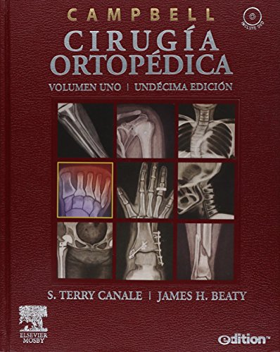 9788480863926: Pack campbell cirugia ortopedica (4 vols.)