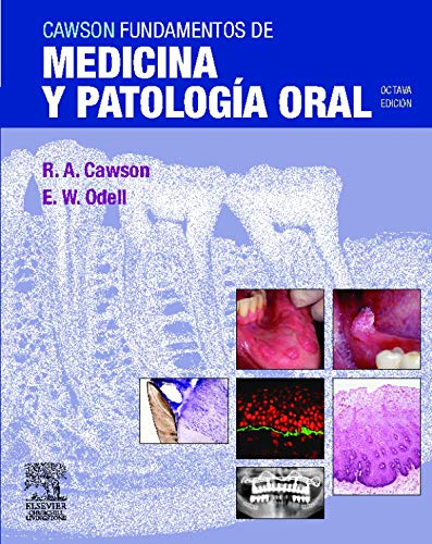 Cawson. Fundamentos de medicina y patologÃ­a oral (9788480864305) by Odell, E.