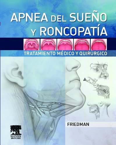 Apnea del sueÃ±o y roncopatÃ­a (Spanish Edition) (9788480864404) by Michael Friedman