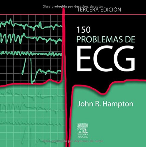 Stock image for 150 Problemas De Ecg (Spanish Edition) for sale by Iridium_Books