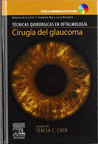 9788480866798: Ciruga del glaucoma + DVD-ROM