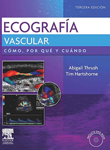 Stock image for Ecografia vascular. Incluye DVD (Spanish Edition) for sale by Iridium_Books