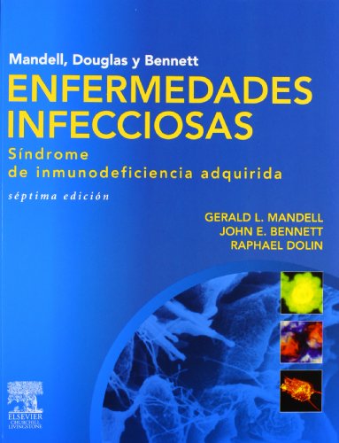 9788480869973: Mandell, Douglas y Bennett. Enfermedades infecciosas. Sindrome de inmunodeficiencia adquirida (Spanish Edition)