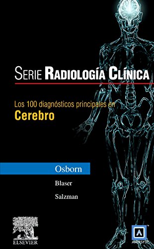 Beispielbild fr Serie Radiologa Clnica: los 100 Diagnsticos Principales en Cerebro zum Verkauf von OM Books