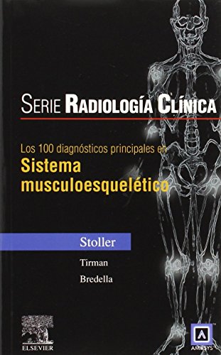 Stock image for 100 Diagnosticos Principales En Sistema Musculoesqueletico (Serie Pocket de Radiologia) (Spanish Edition) for sale by Iridium_Books