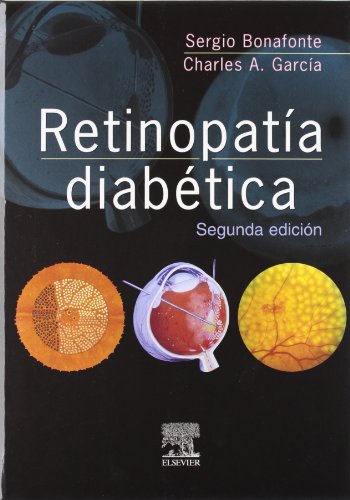 Stock image for Retinopata diabtica (Spanish Edition) for sale by Iridium_Books