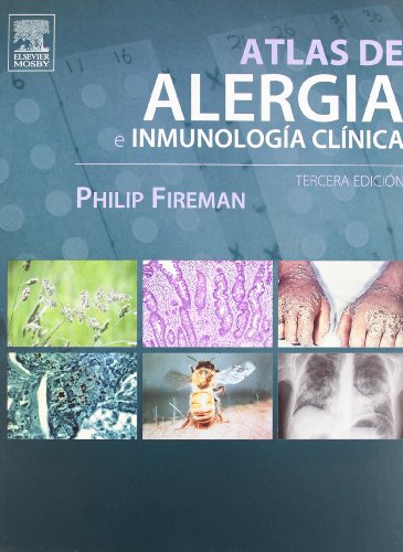 Stock image for Atlas de alergia e inmunologa clnica / for sale by Puvill Libros