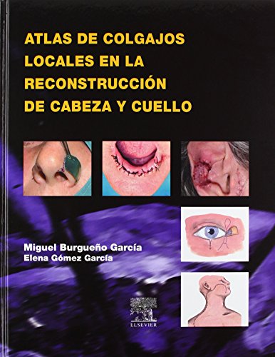 Imagen de archivo de Atlas de colgajos locales en la reconstruccin de cabeza y cuello (Spanish Edition) a la venta por Iridium_Books