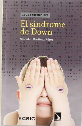 SINDROME DE DOWN,EL