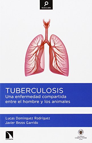 Tuberculosis: Una enfermedad compartida entre el hombre y los animales