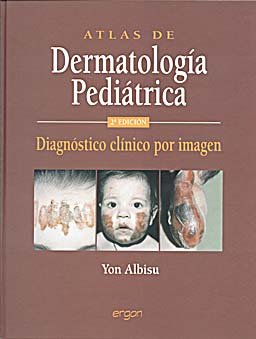 Stock image for ATLAS DE DERMATOLOGIA PEDIATRICA DIAGNOSTICO CLINICO POR IMAGEN for sale by Iridium_Books