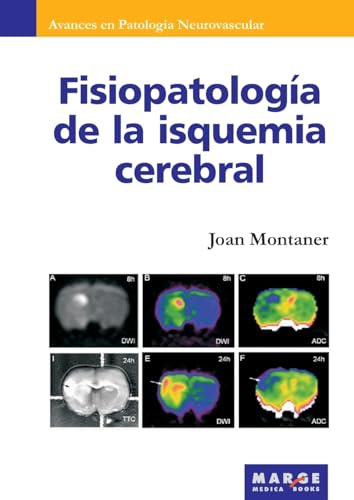 Imagen de archivo de Fisiopatologa de la isquemia cerebral (Spanish Edition) a la venta por California Books