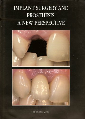 Implant Surgery and Prosthesis: A New Perspective