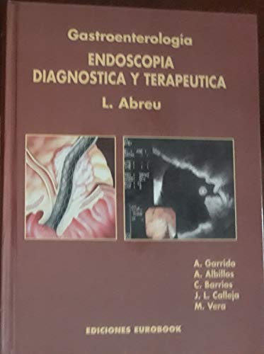 Stock image for Gastroenterologa: Endoscopia diagnstica y teraputica for sale by Tik Books GO