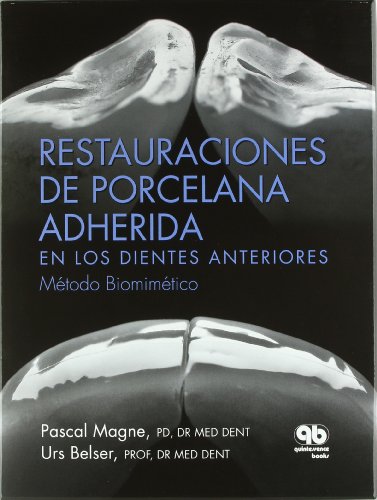 9788489873285: Restauraciones de Porcelana Adherida en los Dientes Anteriores: Un Enfoque Biomimtico