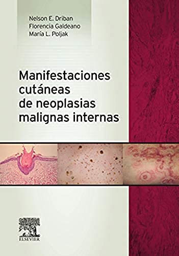 9788490225288: Manifestaciones Cutneas De Neoplasias Malignas Internas