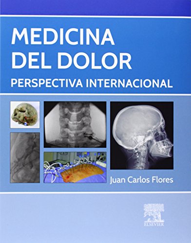 Medicina del dolor: Perspectiva Internacional