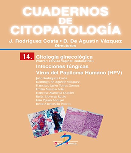 Beispielbild fr CUADERNOS DE CITOPATOLOGA 14. CITOLOGA GINECOLGICA: INFECCIONES FNGICAS.VIRUS DEL PAPILOMA HUMANO zum Verkauf von KALAMO LIBROS, S.L.