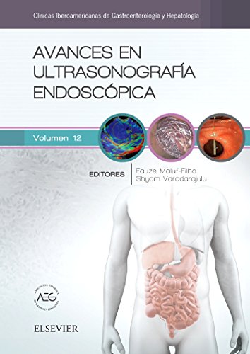 Avances en ultrasonografía endoscópica - Fauze Maluf and Shyam S. Varadarajulu