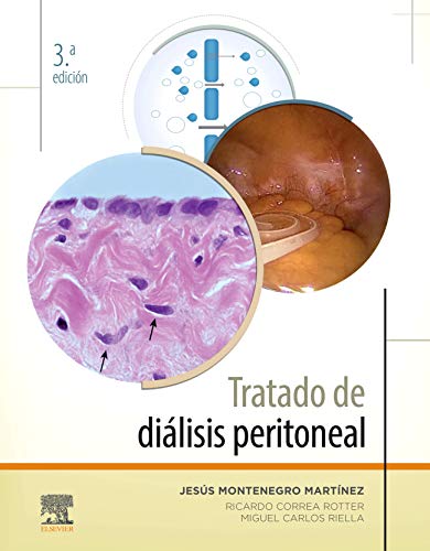 Stock image for Tratado de dilisis peritoneal (3 ed.) for sale by Agapea Libros