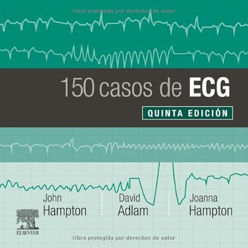 Beispielbild fr 150 casos de ECG zum Verkauf von Books Unplugged