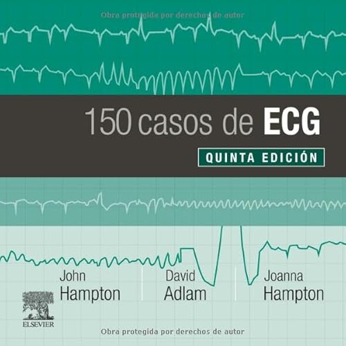 Imagen de archivo de 150 CASOS DE ECG a la venta por Antrtica