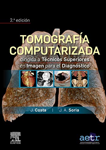 Imagen de archivo de TOMOGRAFIA COMPUTARIZADA DIRIGIDA TEN.SUPER.IMAGEN a la venta por Antrtica