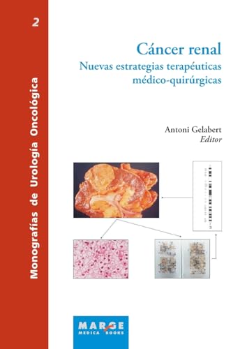 Imagen de archivo de Cncer Renal. Nuevas Estrategias Terapeuticas Medico-quirurgicas a la venta por Hamelyn